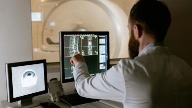 الأشعة المقطعية (CT Scan)