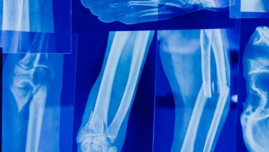 الأشعة السينية (X-Ray)