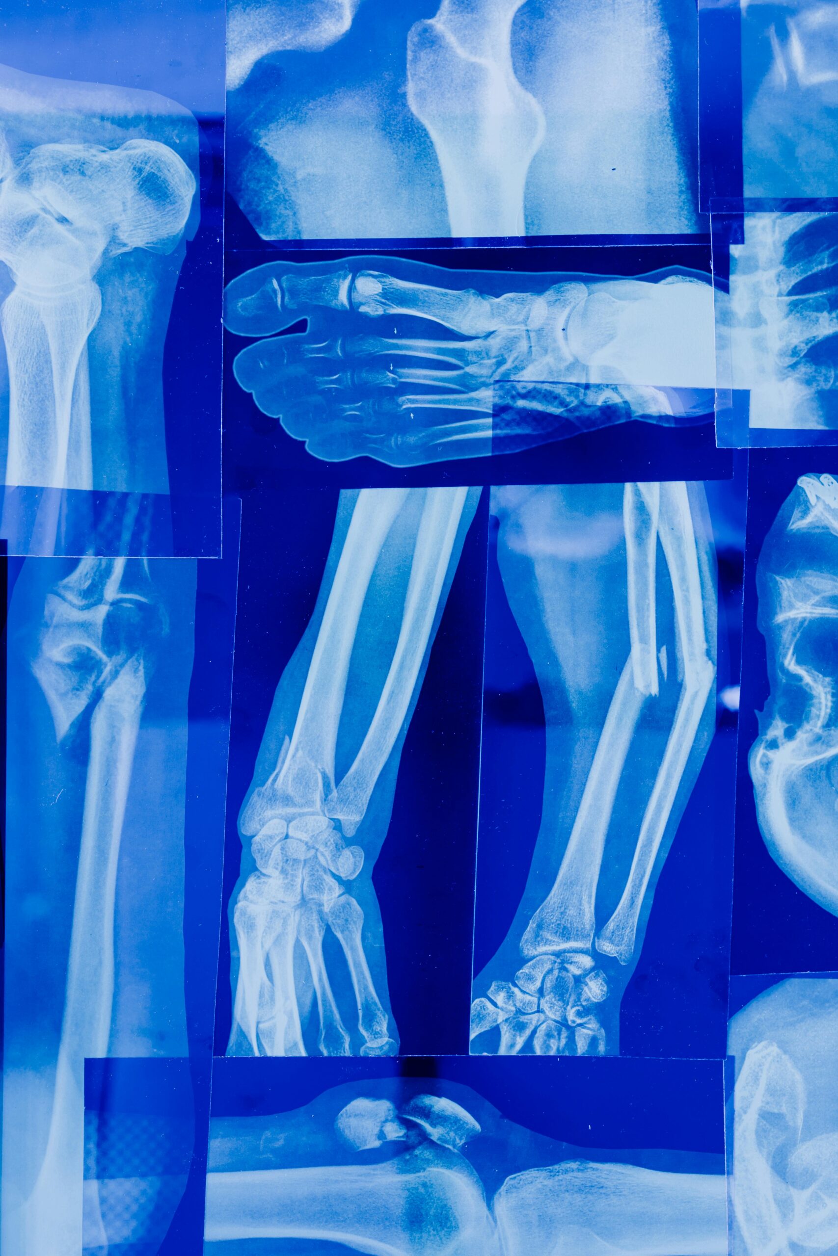 الأشعة السينية (X-Ray)